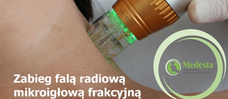 Nowy zabieg  na zmarszczki i blizny – fala radiowa mikroigłowa