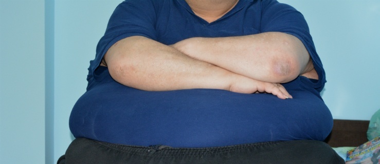 Elblążanin, który waży 250 kilogramów: „Jestem skazany na śmierć”