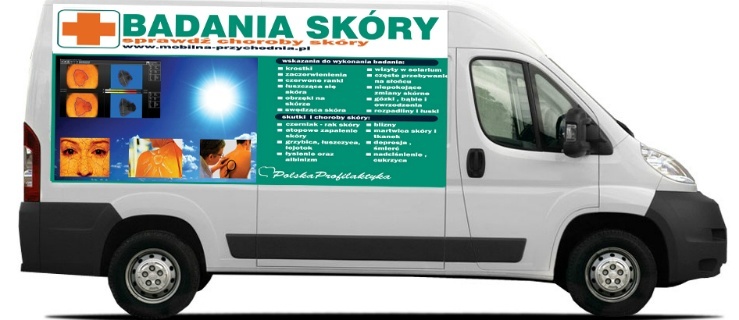 Sprawdź czy masz czerniaka. Bezpłatne badania dermatologiczne w Elblągu