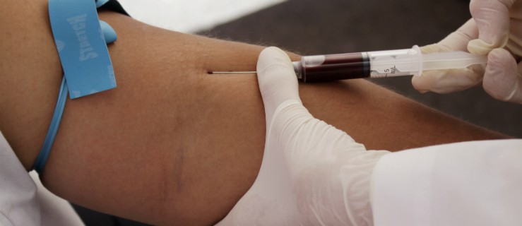 W Elblągu rozpocznie się promocja testów na obecność HIV 