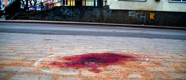  Daj znać: Kałuża krwi na Robotniczej. Na to patrzą dzieci 