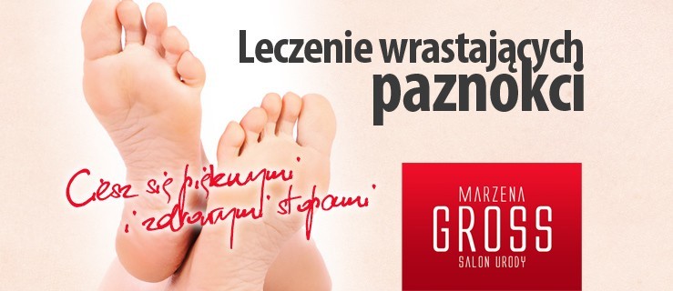 Cierpisz przez wrastanie paznokci? Nie musisz się dłużej męczyć!